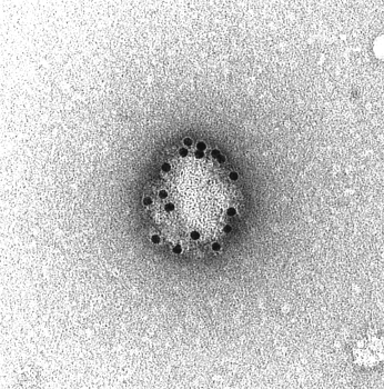 bunyavirus